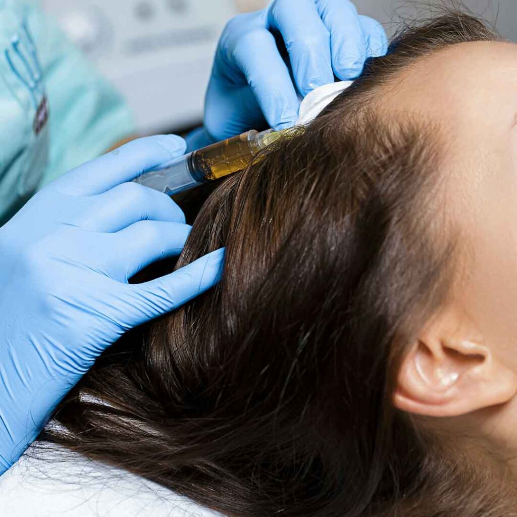 mezoterapia